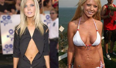 Worst Cases Of Celebrity Plastic Surgery Gone Wrong