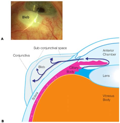 Conjunctiva Anatomy Anatomy Reading Source