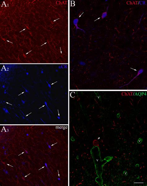 Confocal Microscopy Of Double Immunofluorescent Staining For ChAT And