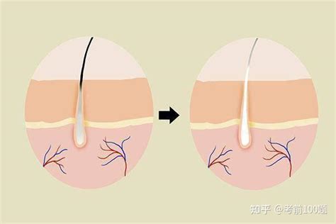 心知肚明男性如果此部位的毛发变白说明寿命在逐渐减少了解吗 知乎