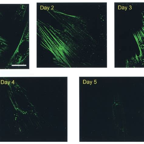 Staining Of Cellular Actin Cytoskeleton In Live Eiav Infected Ed Cells