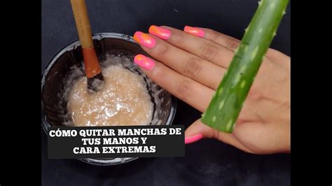 CÓMO QUITAR MANCHAS DE TUS MANOS Y CARA EXTREMAS REMEDIO CASERO PARA