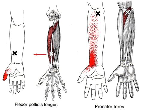 Flexor Pollicis Longus - fingersandfeathersh