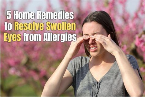 5 Home Remedies for Swollen Eyes from Allergies