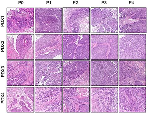 Comparative Histological Section He Of The Esophageal Patient Download Scientific Diagram