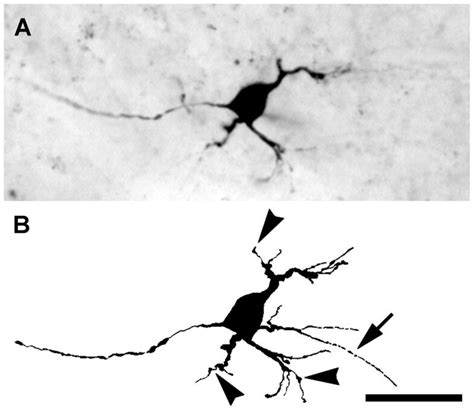 A A Micrograph Of A Bda Labeled Dlgn Projection Neuron With Swollen