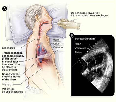 Heart Tests - Heart Tests | NHLBI, NIH