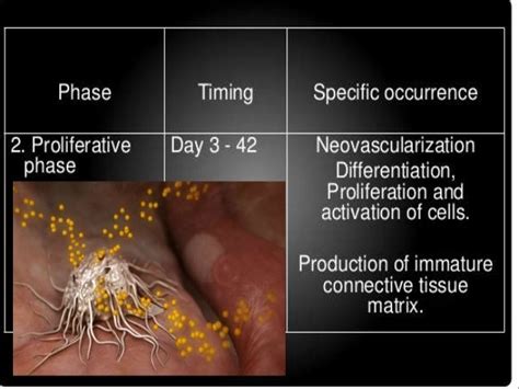 Osseointegration