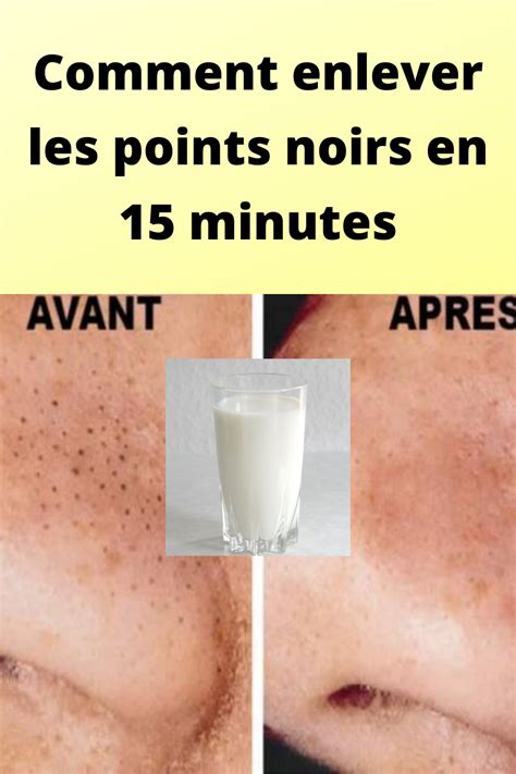 Comment Enlever Les Points Noirs En Minutes Point Noir Tache Peau