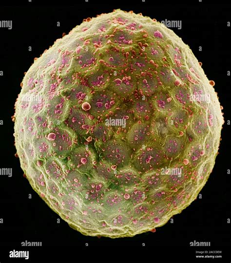 Protoplast. Coloured scanning electron micrograph (SEM) of a tobacco plant (Nicotiana tabacum ...