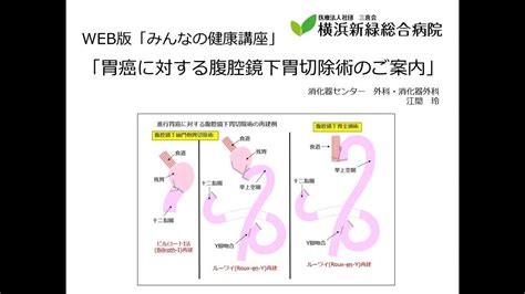 胃癌に対する腹腔鏡下胃切除術のご案内 Youtube