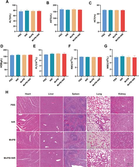 Frontiers Manganese Based Prussian Blue Nanoparticles Inhibit Tumor