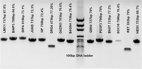 Solis Biodyne 5x Hot Firepol® Gc Master Mix