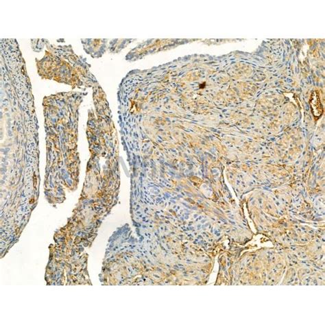 Phospho Enos Ser1177 Antibody Affinity Biosciences