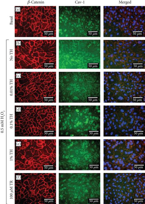 Localization of β catenin and caveolin 1 in HUVECs pretreated with TH