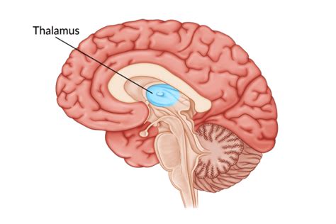 Thalamic Stroke Effects Treatment And Recovery Process