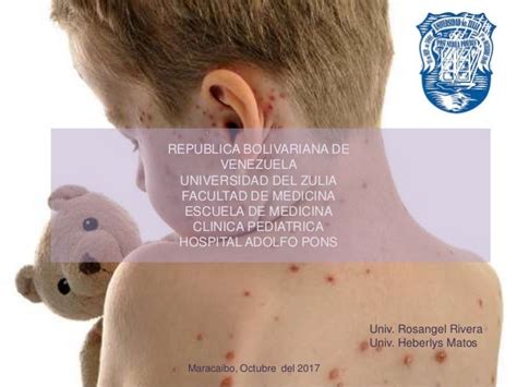 Enfermedades Exantematicas En Pediatria