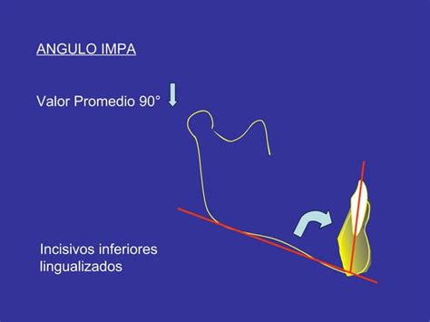 Análisis De Tweed Ppt