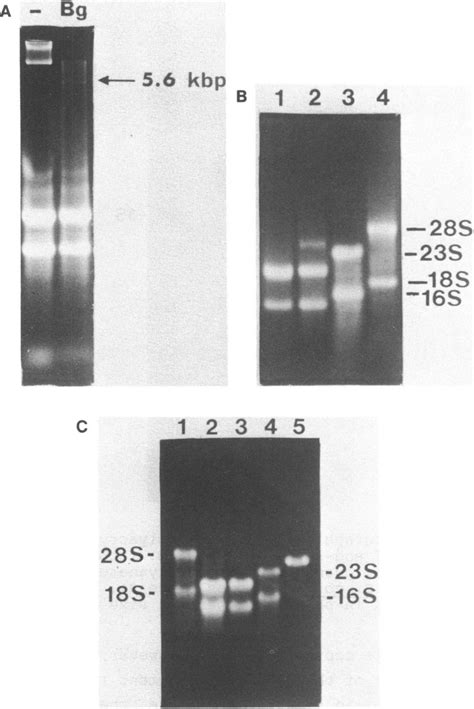 A Non Denaturing Agarose Gel Electrophoreis Of Total G Lamblia Download Scientific Diagram