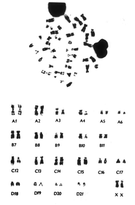 G Banding Karyotype Of A Transgenic Female Rabbit 2n 44 XX