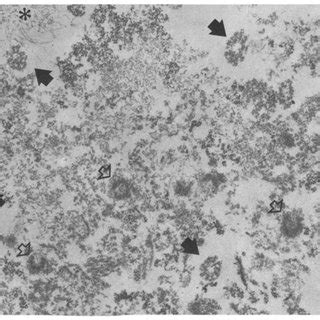 Low Power Electron Micrograph Illustrating The Overall Composition Of