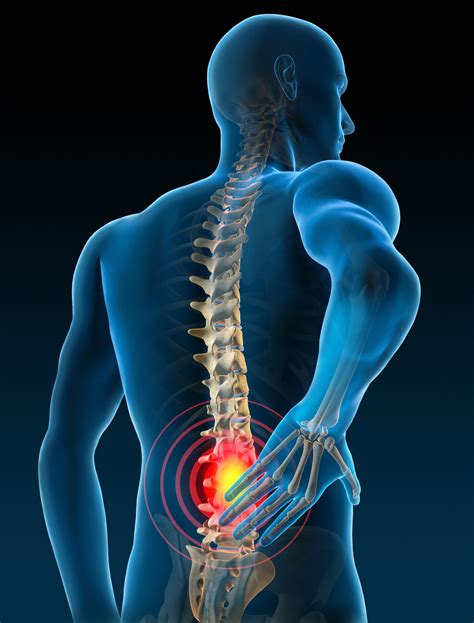 Sacral Neuromodulation Z Urology