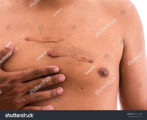 Naked Valves Images Stock Photos Vectors Shutterstock