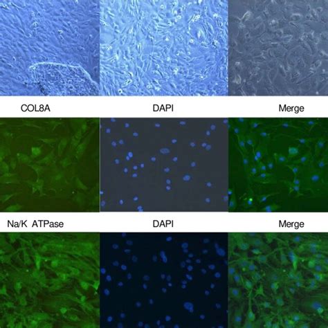 A M Orphological Analysis Of Cultured Corneal Endothelial Cells