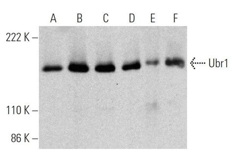 Ubr1抗体 A 5 SCBT Santa Cruz Biotechnology