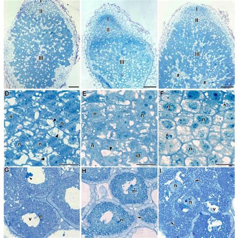 Phenotypes Of Plants And Nodules Of Pea Pisum Sativum L Laboratory