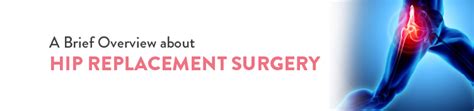 A Brief Overview About Hip Replacement Surgery Ck Birla Hospital