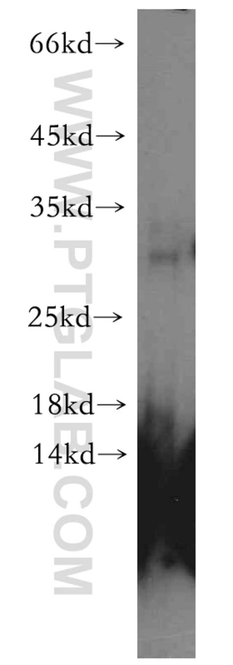 Chmp B Rabbit Anti Human Mouse Rat Polyclonal Proteintech L