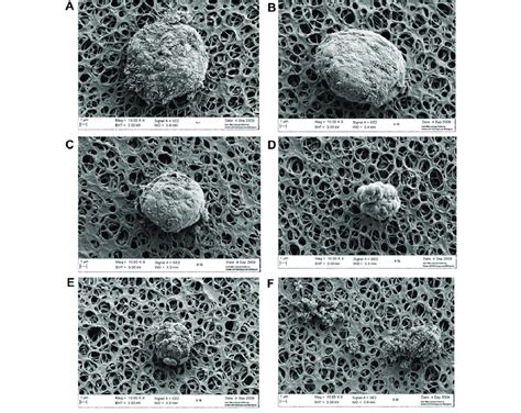 Sem Micrographs Of Surface Ultrastructural Characteristic Of Hepg