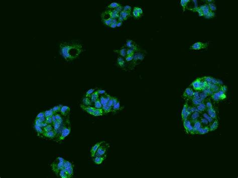 Anti TTR Transthyretin Antibody Rabbit Anti Human Polyclonal LSBio