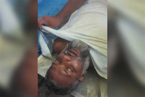 West Bengal Panchayat Election 2023 Tmc Worker Allegedly Killed By