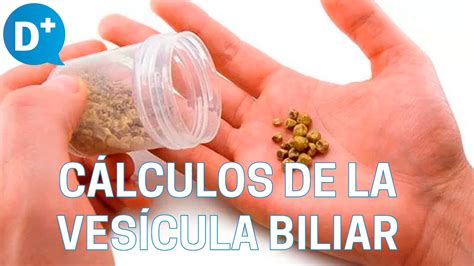 Portátil Lechuga S T Por Que Salen Los Calculos En La Vesicula Riego En