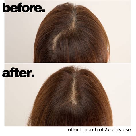 OLD Scalp Hair Essence (Promotes Hair Growth)