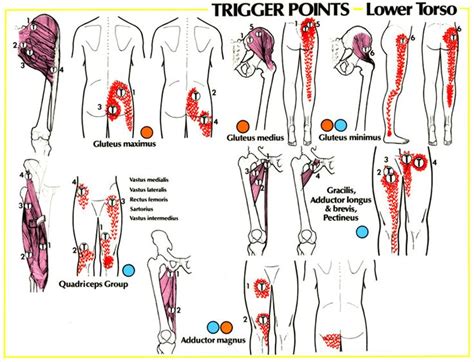 78+ images about Trigger Point Therapy on Pinterest | Muscle knots ...