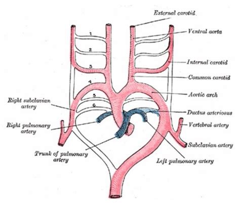 Major Aortopulmonary Collaterals Drsvenkatesan Md