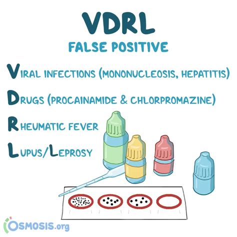 Syphilis Diagnosis Syphilis Treatment