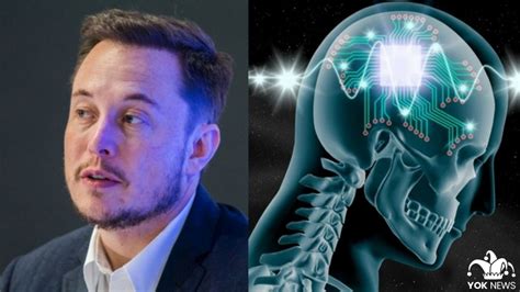 Así Funciona Neuralink El Sistema De Elon Musk Que Conecta Tu Cerebro A Internet Yok Medios