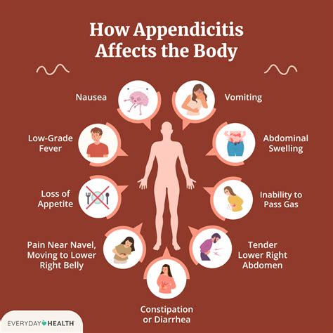 Symptoms Of Appendicitis Nausea Fever Abdominal Pain And More