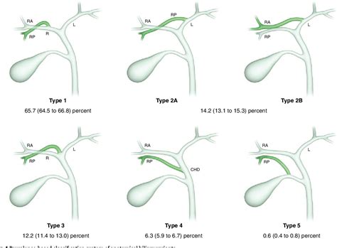 Figure 1 From Comprehensive Classification Of Anatomical Variants Of