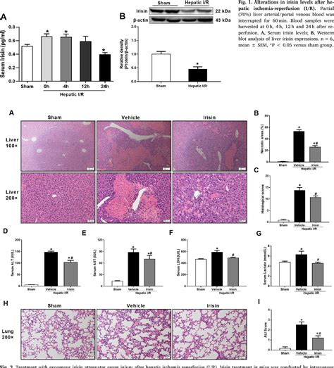 Figure From Irisin Alleviates Liver Ischemia Reperfusion Injury By