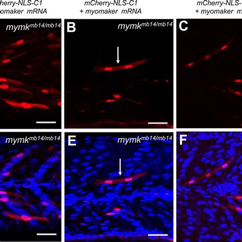 The Effects Of Shh Mrna Injection On Mymk Expression And Myoblast