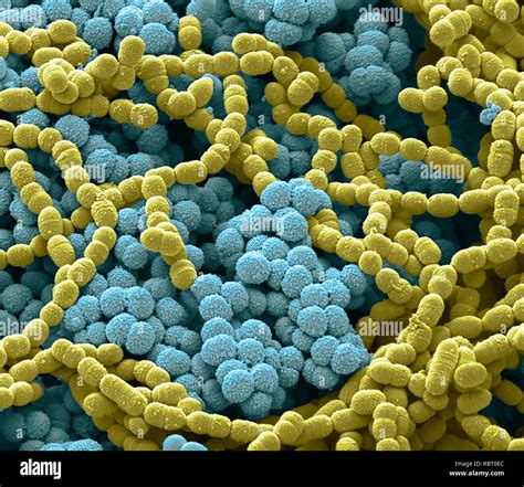 Streptococcus Pneumoniae Culture