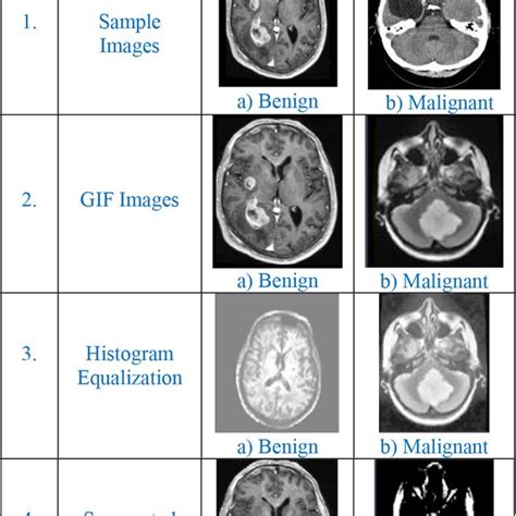 Intermediate results of the MRI image | Download Scientific Diagram