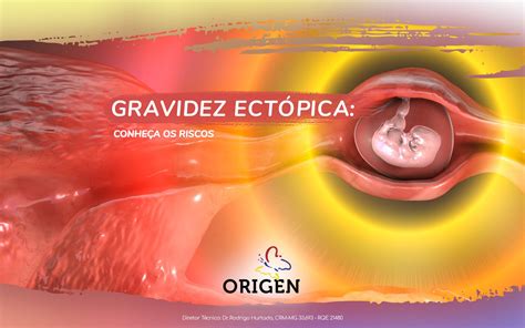 Gravidez Ect Pica O Que Causas Diagn Stico E Tratamento