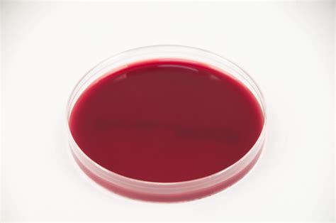 Brain Heart Infusion Agar W Horse Blood And Taurocholate Bhiy Ht