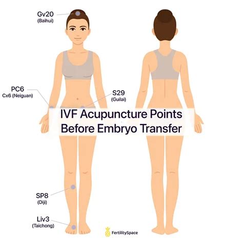 Ivf Acupuncturist Explains Benefits Of Fertility Acupuncture